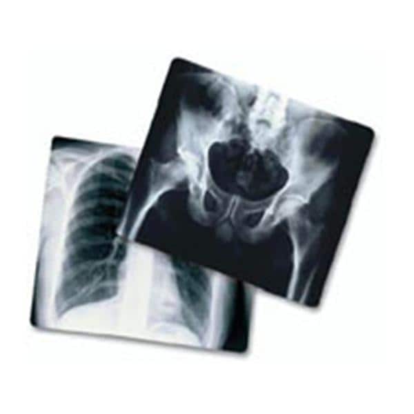 Radiomat Mplu X-Ray Film 100/Bx