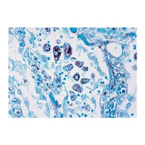 Richard-Allan Stain Kit Modified Grocott's Methenamine Silver Ea