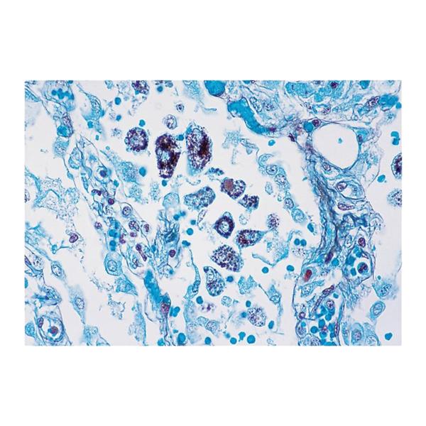 Richard-Allan Stain Kit Modified Grocott's Methenamine Silver Ea