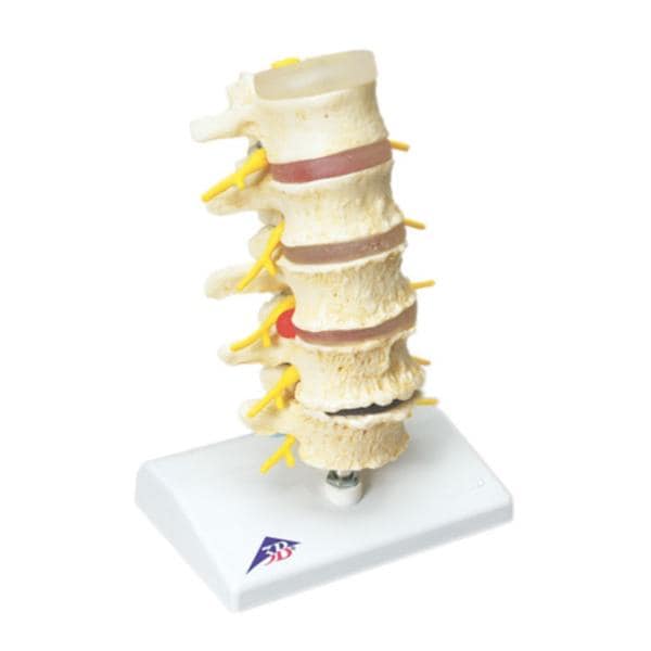 Vertebrae Degeneration Anatomical Model Ea
