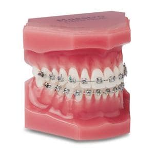 Maestro® Mini-Twin® Roth Rx Bracket .018 UL3 -2T 13A 4MO 10/Pk