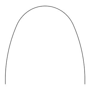 Bio-Kinetix Plus Archwire Etched Thermal Nitanium 0.014 in x 0.025 in Ea