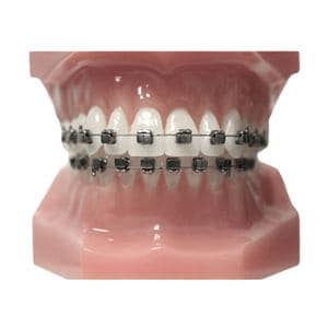 Carriere® SLX® 3D Typodont Ea