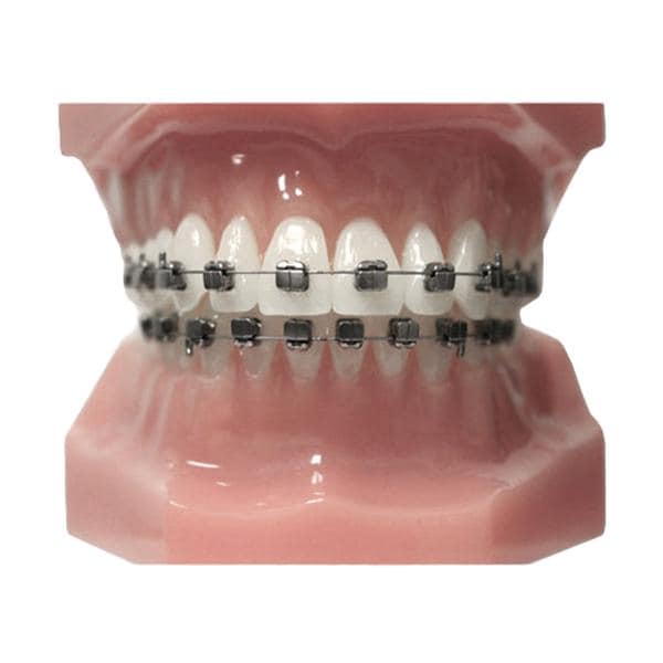 Carriere® SLX® 3D Typodont Ea