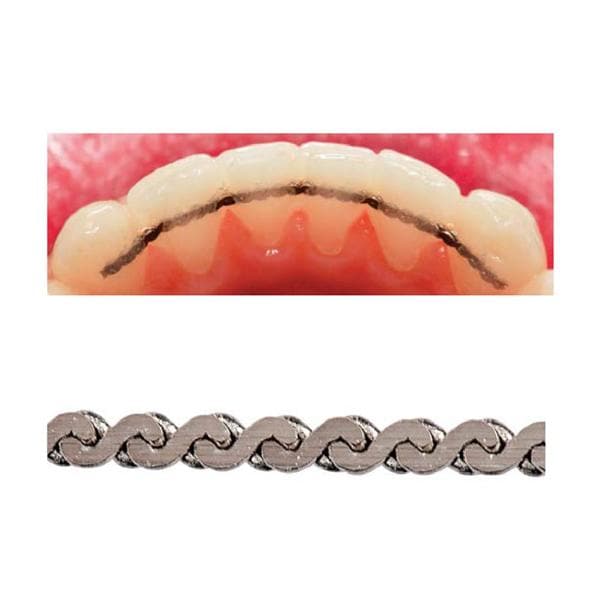 FlexTech Retention System Ea