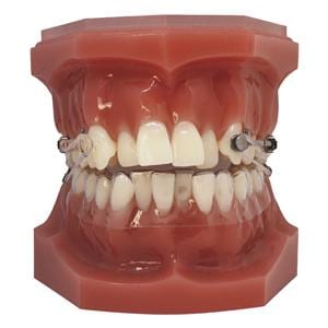 Carriere Motion Pro & Motion Pro Clear Typodont Ea