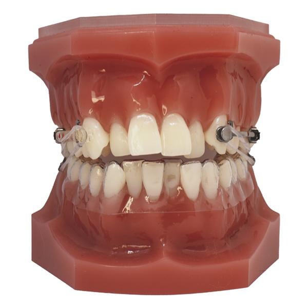 Carriere Motion Pro & Motion Pro Clear Typodont Ea