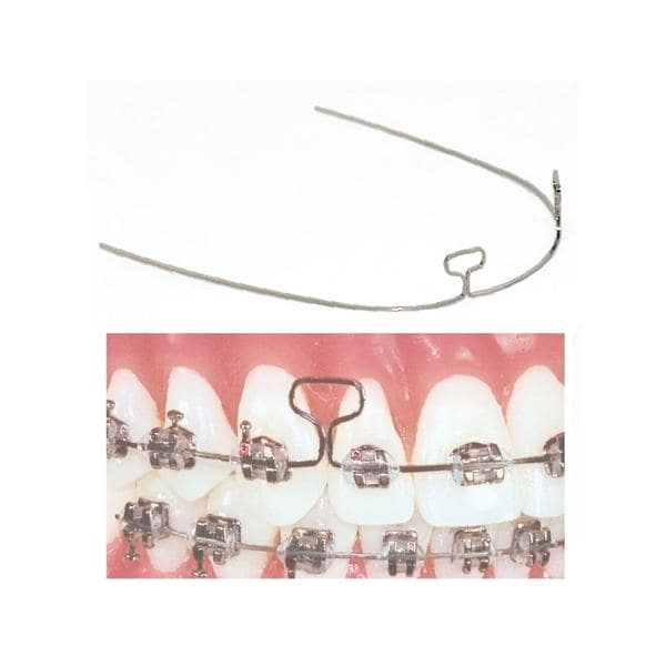 TruForce Archwire Retraction T-Loop Stainless Steel 0.017 in x 0.025 in 10/Pk