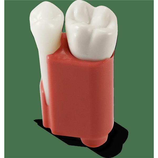 Acadental Root Canal Treatment Endo/Practice Unisex Endodontic Tooth Ea