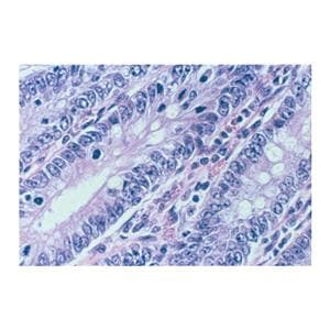 Nu-Clear II Acid Alcohol Solution Ea