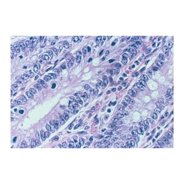 Nu-Clear II Acid Alcohol Solution Ea