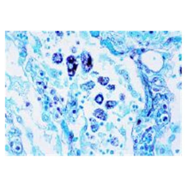 Silver Stain Methenamine/Borax Ea