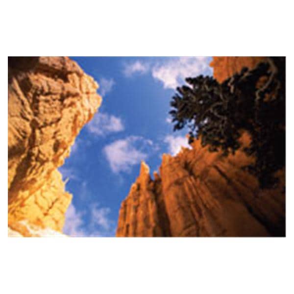 CeilingScenes Light Lens Stone Canyon 1-Tile Square 24 in x 24 in Ea