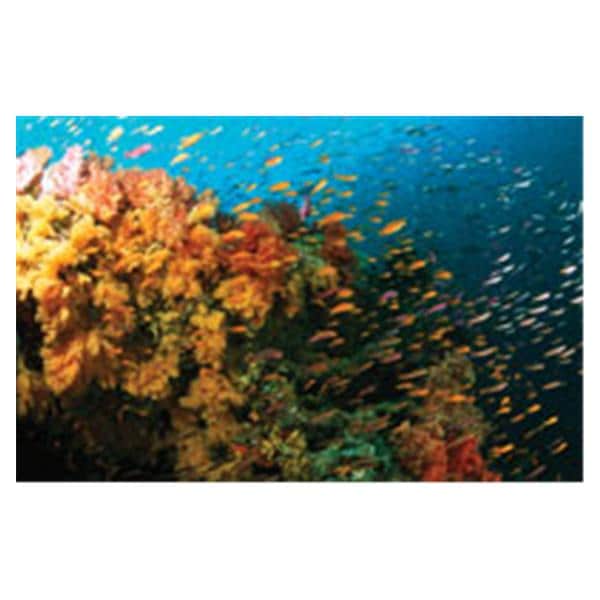 CeilingScenes Light Lens Fiji Reef 2-Tiles Vertical 24 in x 48 in Ea