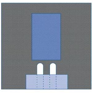 77x80" Sterile Surgical Drape Fenestrated