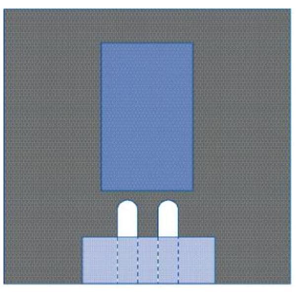 77x80" Sterile Surgical Drape Fenestrated