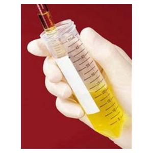 Fisherbrand Centrifuge Tube Polypropylene 15mL 119mm Sterile 500/Ca