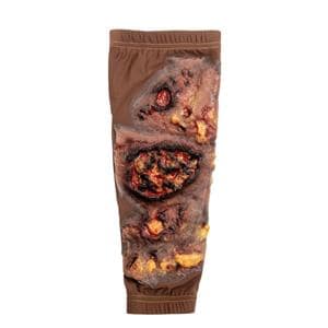 STOPS Medical Lower Leg Skin Burn Sleeve Ea