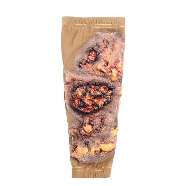 STOPS Medical Lower Leg Skin Burn Sleeve Ea