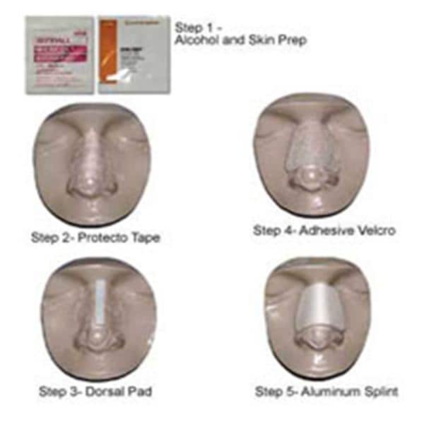 Denver Series 5000 Post-Op Splint Nasal Size Small/Medium Aluminum/Foam 65x35mm