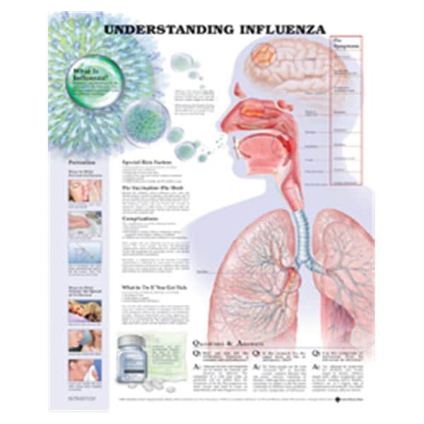 Understanding Influenza 20x26" Educational Chart Ea