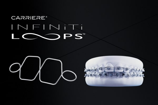 InfiNiTi Loops Power Closer
