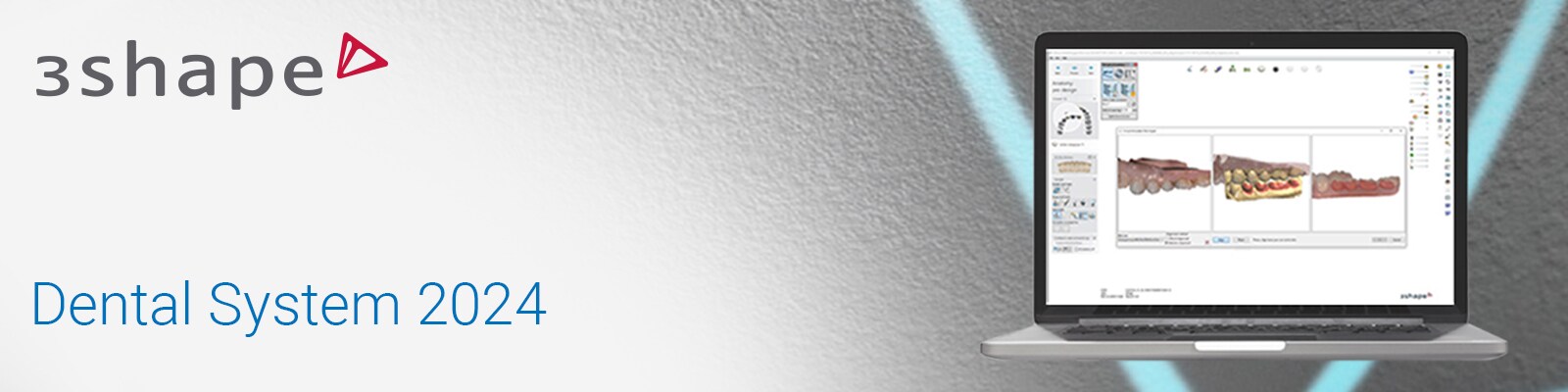 3Shape Dental System 2024