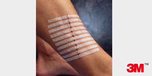 cierres de piel adhesivos - 3M&trade;